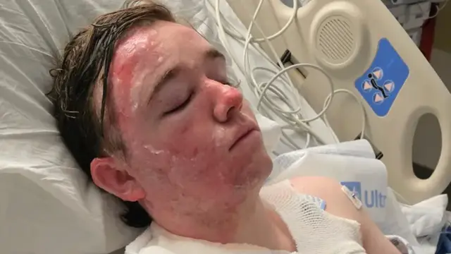 Employee Hospitalized in ICU Following Hot Oil Assault by Co-Worker
